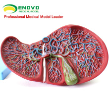 VISCERA07(12544) Medical Science Human Liver Model for Teaching